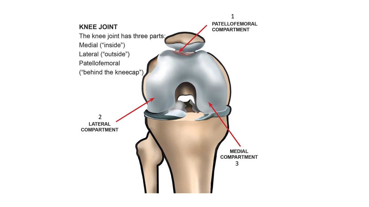 Is Knee Ligament Surgery Right For You?