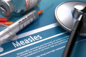 53 Samoans Dead from Measles Outbreak