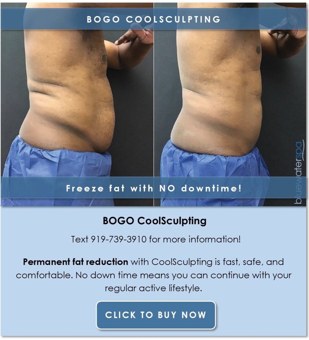Purchase BOGO CoolSculpting