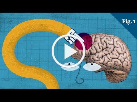Why the teenage brain has an evolutionary advantage