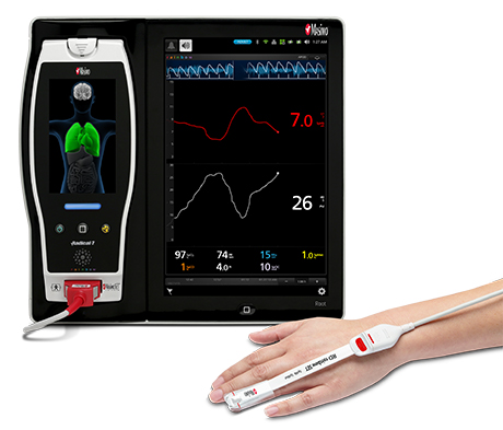 Masimo Root® with SpHb®