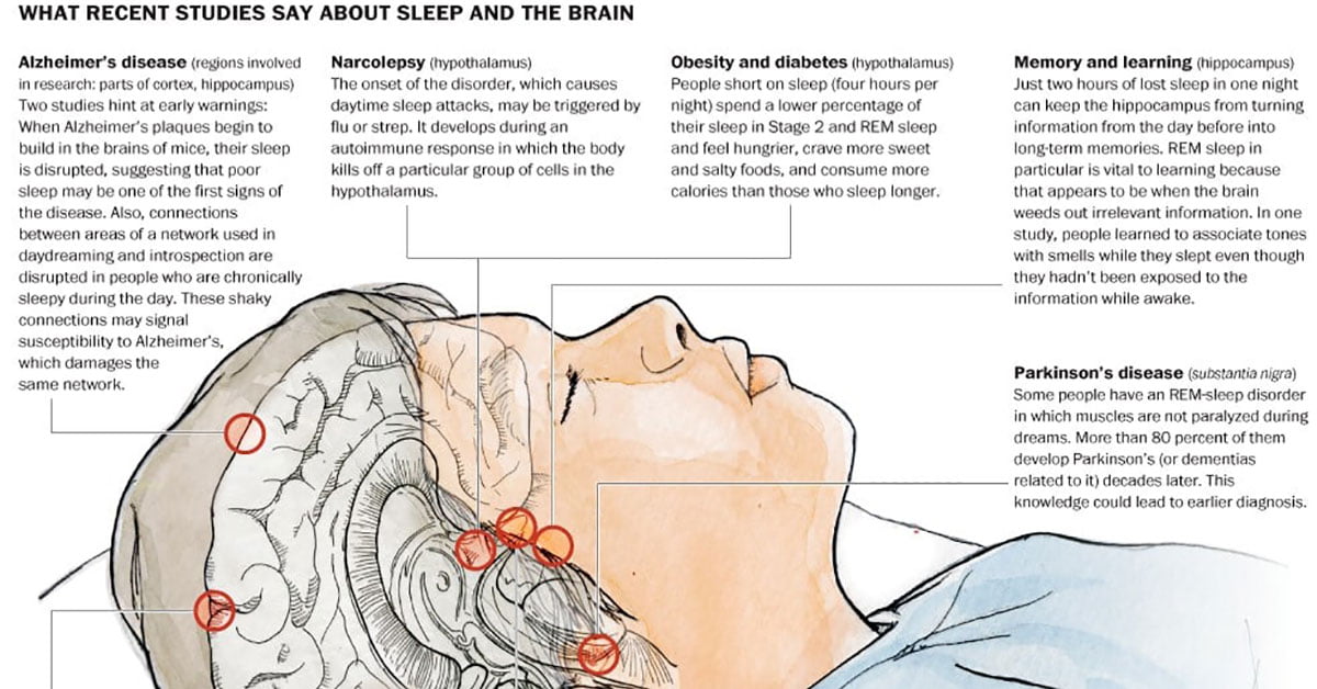 Disrupted Sleep Seems To Be Linked To Alzheimer's Amyloid Plaques
