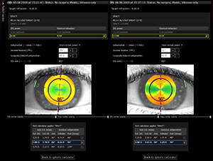 Cataract App