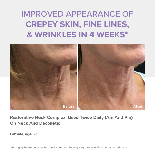Improved appearance of skin in just 4 weeks! 