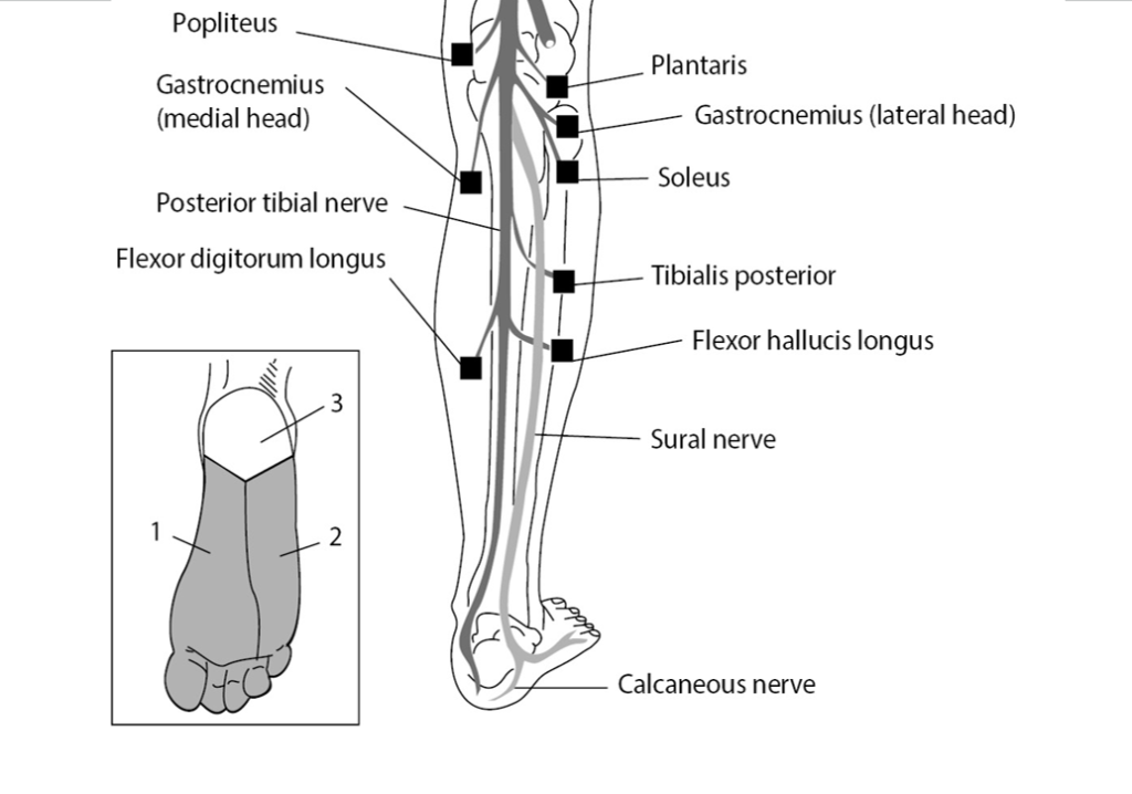 Tibial Nerve Injury: Symptoms, Diagnosis, and Treatment Options