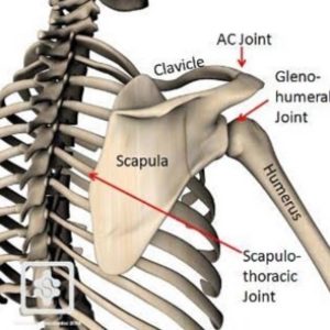 Snapping Scapula: Expert Advice You Need to Know