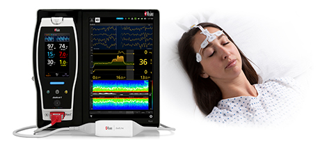 Masimo SedLine® Brain Function Monitoring