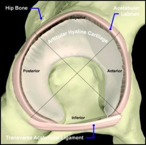 Hip Labral Tear with Pain Down Leg: Surgery???