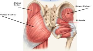 Gluteal Tendinopathy: 3 Causes You Need to Know!