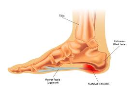 Ankle Pain When  Running: Six Major Causes and Treatment Options