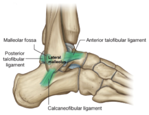 How Long Does a Sprained Ankle Stay Swollen: Facts You Need to Know!