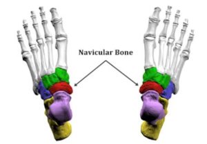 3 Things to Know About Navicular Bone Pain