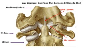 Patient with Alar Ligament Injury Travels From Italy for Help