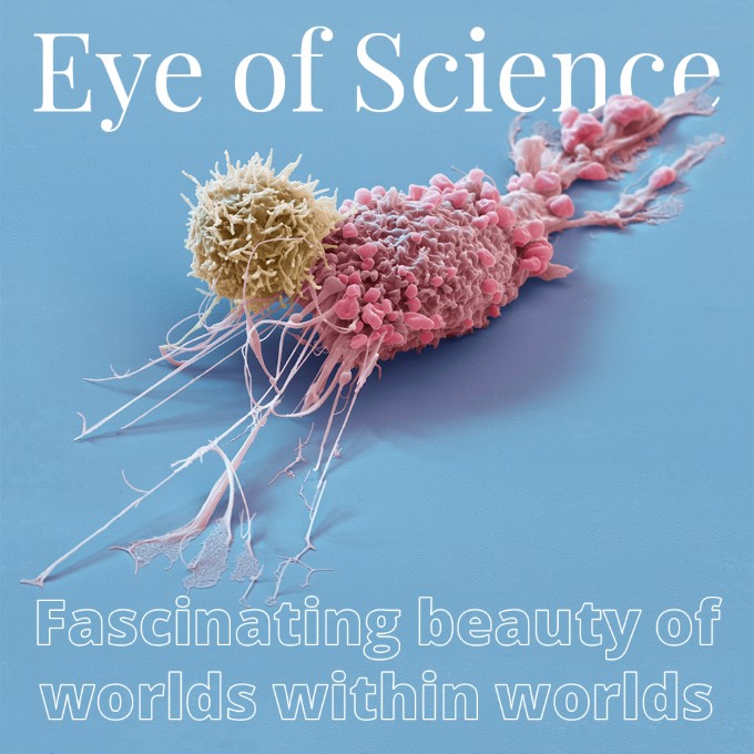 Eye of Science - Fascinating beauty of worlds within worlds