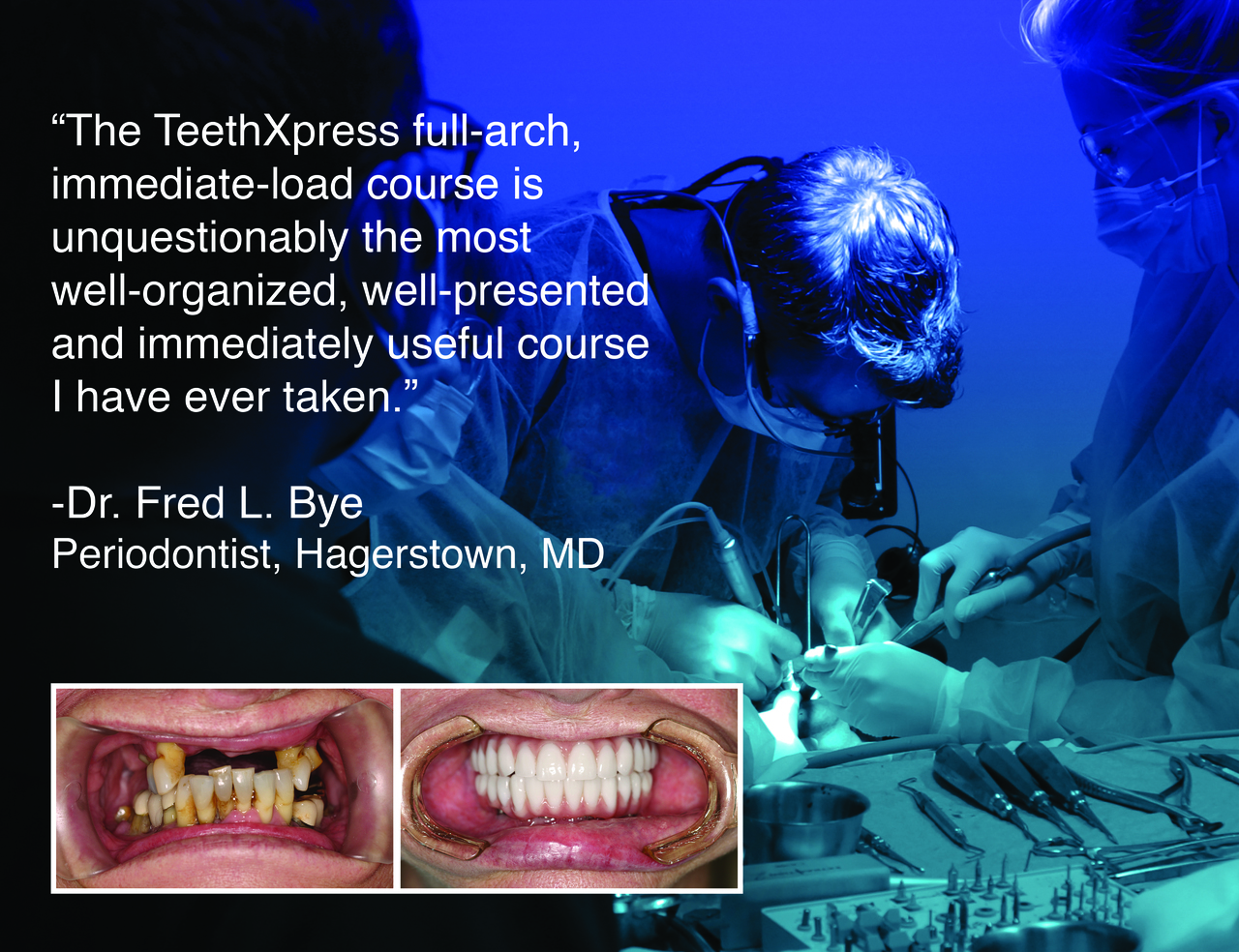 The TeethXpress full-arch, immediate-load course is unquestionably the most well-organized, well-presented and immediately useful course I have ever taken.